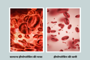 Hemoglobin Deficiency हीमोग्लोबिन की कमी को कैसे दूर करें